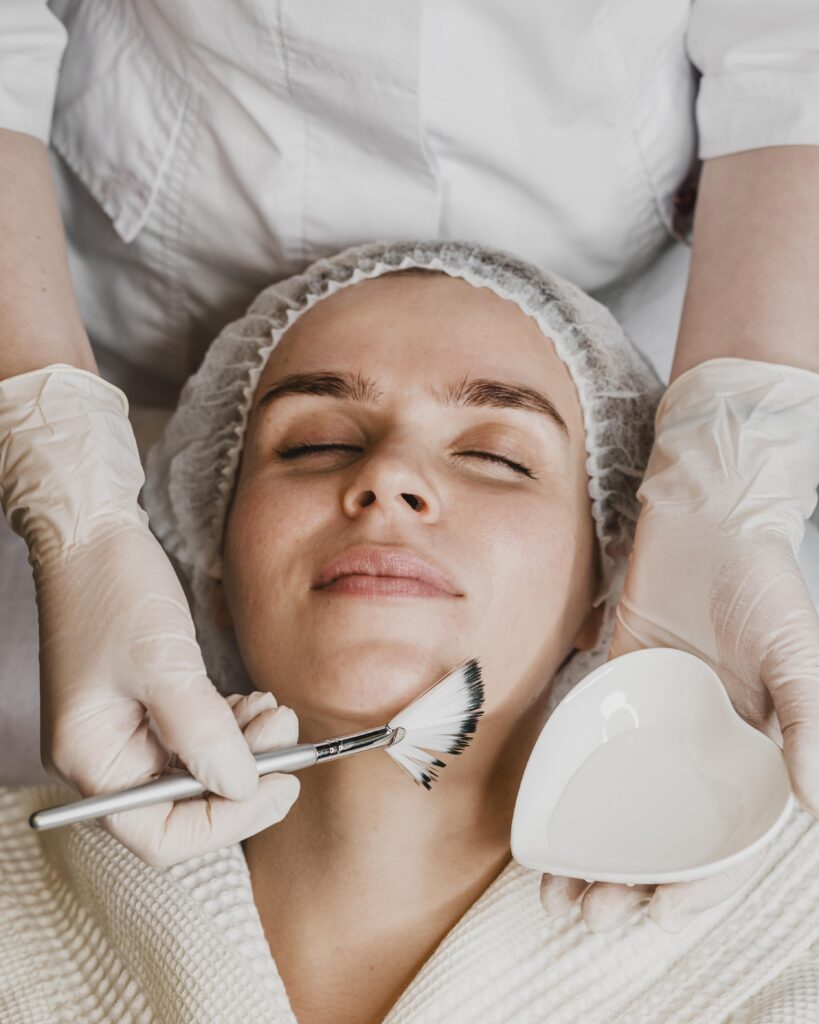 Quy trình peel da trị mụn Cần Thơ minh họa từng bước chuẩn y khoa