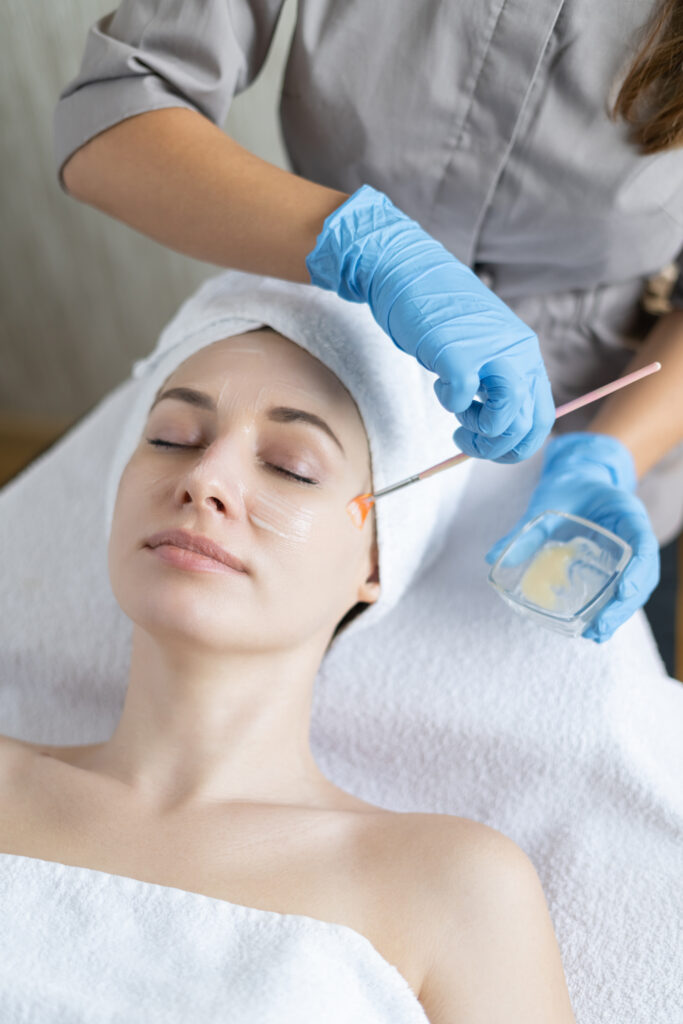 Hiệu quả của peel da trị mụn chuẩn y khoa Cần Thơ tại Lona Skin Lab