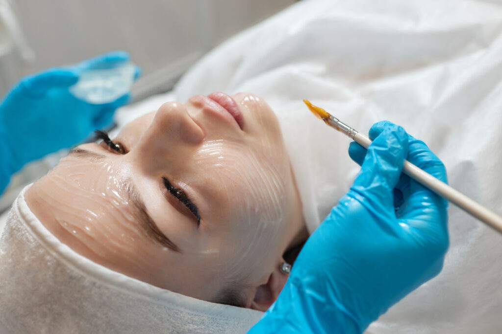 Peel da trị mụn Cần Thơ, peel da trị mụn chuẩn y khoa tại Cần Thơ đồng hành cùng khách hàng