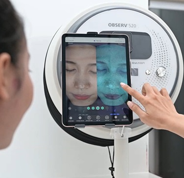 Ứng dụng máy soi da trong quản lý mụn và cải thiện chăm sóc da cho bệnh nhân.