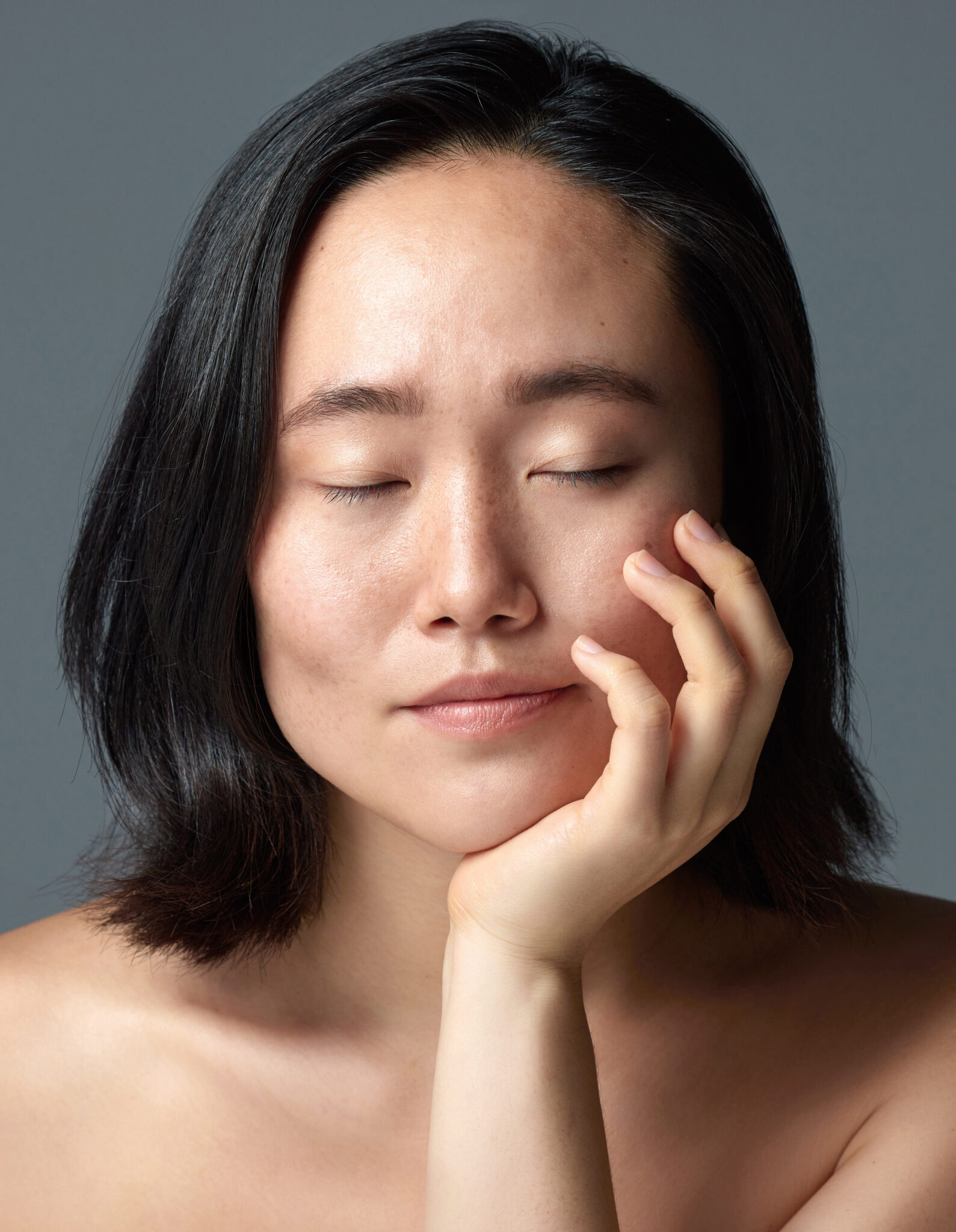Hình ảnh minh họa tăng sắc tố trên da, điều trị tăng sắc tố tại Lona Skin Lab