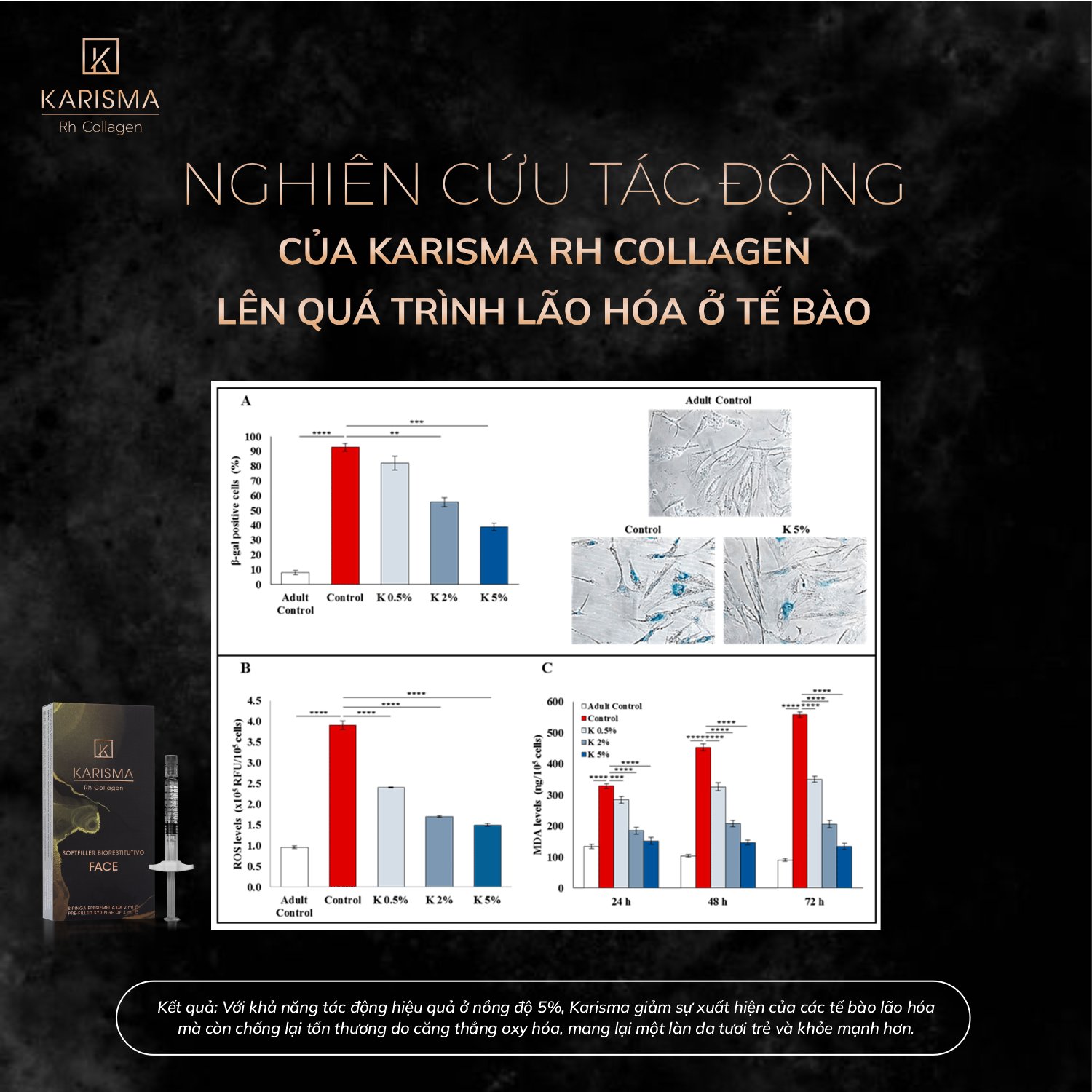 Ảnh được chụp trong quy trình tiêm karisma hiện đại, nhấn mạnh công dụng karisma trong việc làm đầy và duy trì độ trẻ trung.