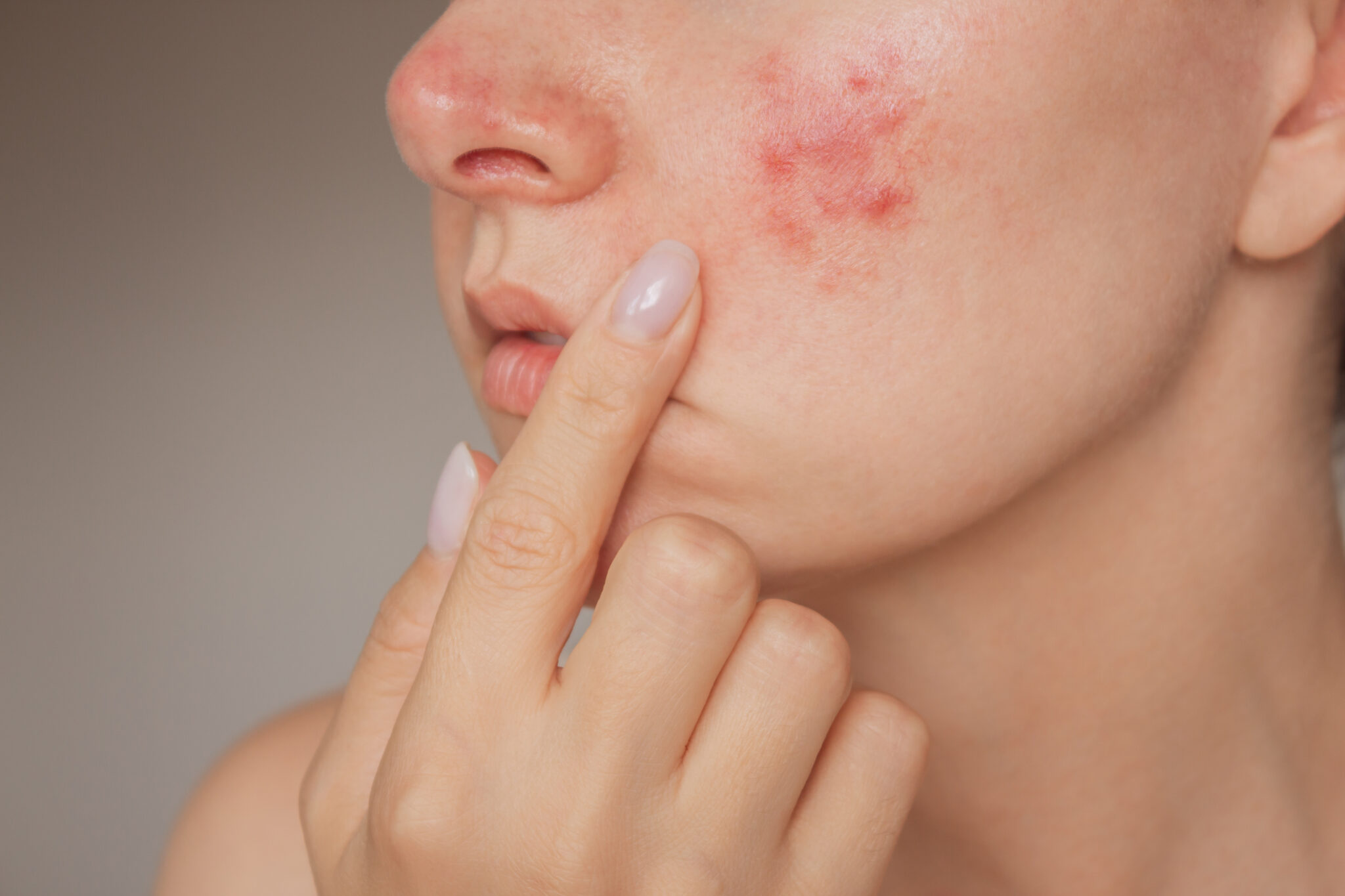 Chăm sóc da toàn diện: vi sinh trên da và prebiotics trong chăm sóc da giúp duy trì độ ẩm