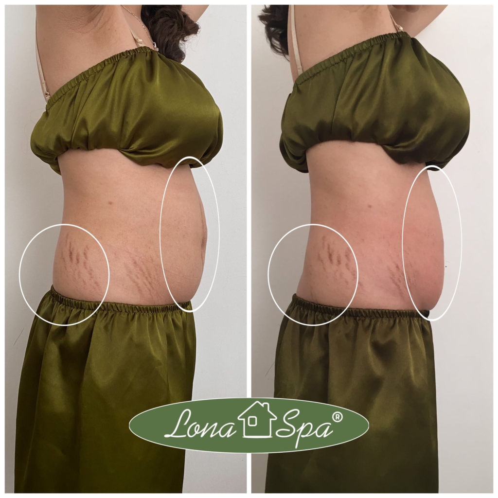 Phương pháp Bùn cứu dưỡng sinh và Bùn cứu đã được chứng minh giúp đả thông kinh lạc hiệu quả, đồng thời hỗ trợ quá trình Giảm béo dưỡng sinh và Trị liệu cổ vai gáy, tạo nên sự phục hồi da tự nhiên chuyên sâu.