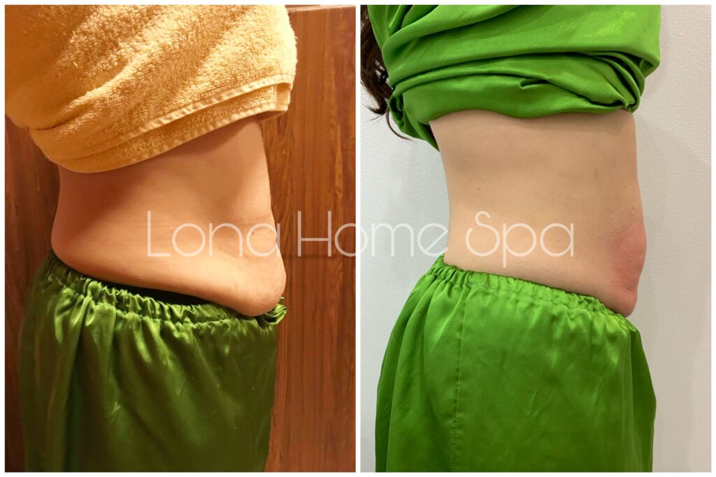 Hiệu quả của Bùn cứu dưỡng sinh kết hợp Bùn cứu được khẳng định qua việc đả thông kinh lạc, đồng thời thúc đẩy Giảm béo dưỡng sinh và cải thiện Trị liệu cổ vai gáy trong các liệu trình thẩm mỹ chuyên sâu.