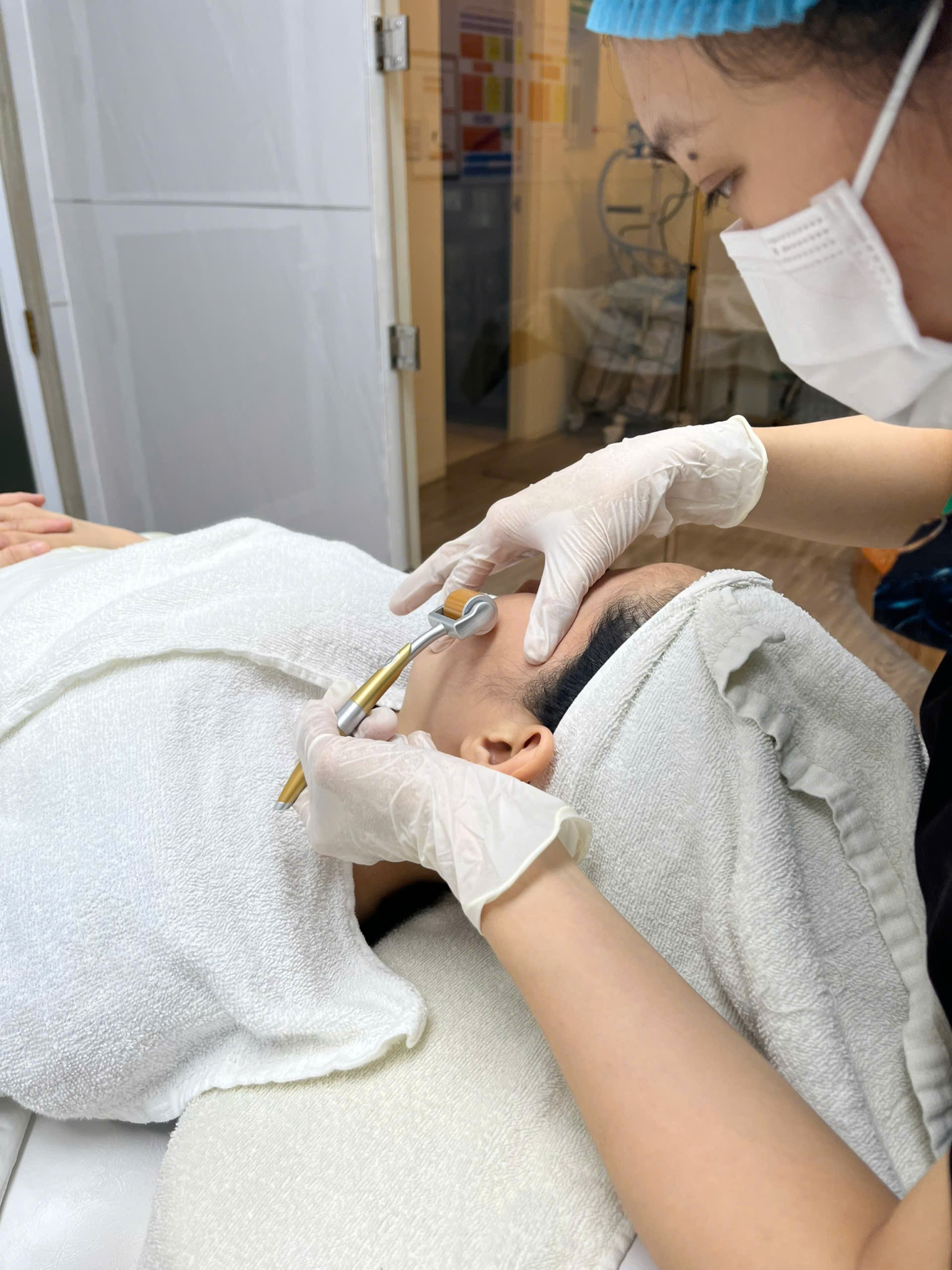 Bác sĩ da liễu trị sẹo rỗ giỏi Cần Thơ sử dụng phương pháp lăn kim; bác sĩ da liễu trị sẹo rỗ giỏi Cần Thơ, trị sẹo rỗ Cần Thơ được hỗ trợ công nghệ lăn kim tiên tiến khi trị sẹo rỗ.