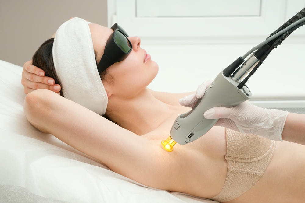 Quy trình triệt lông bằng laser ND:YAG tại phòng khám