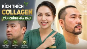 PLLA là gì? Giải pháp cân chỉnh gương mặt hóp sau giảm cân