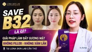 Mặt gầy gò, hốc hác? Đây là cách làm đầy tự nhiên không cần Filler!