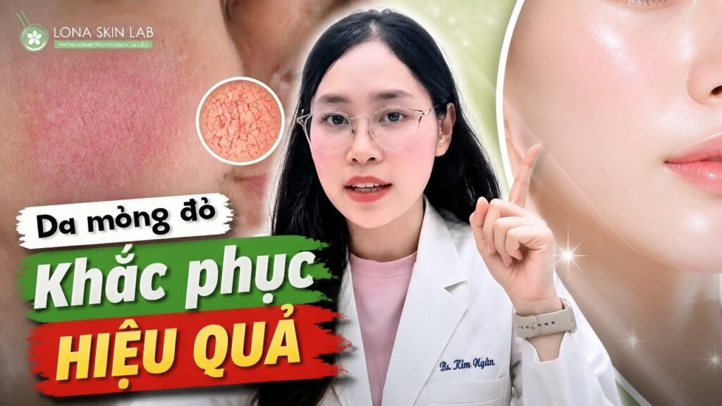 Tại Sao Da Bạn Lại Mỏng Đỏ & Giãn Mao Mạch? Bác Sĩ Giải Đáp