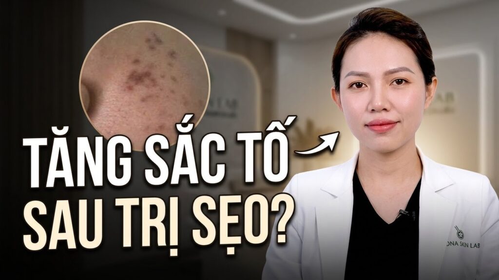 Trị sẹo xong bị thâm: Làm sao để da đều màu trở lại?