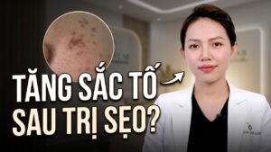 Trị sẹo xong bị thâm: Làm sao để da đều màu trở lại?