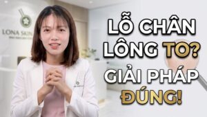 Mình bị lỗ chân lông to phải làm sao?