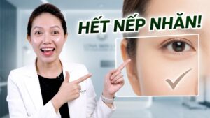Phân biệt và xử lý nếp nhăn đuôi mắt và nếp chân chim