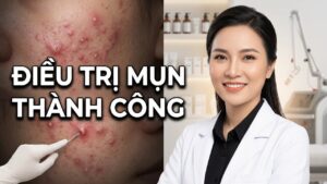 Muốn hết mụn nhanh? Hãy nắm vững các yếu tố quyết định này