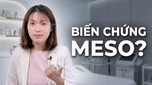Sự thật về biến chứng Meso: Chị em cần lưu ý những gì?