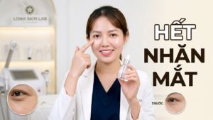 Chăm sóc vùng mắt để có đôi mắt sáng