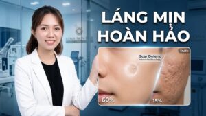 Sẹo rỗ sau mụn: Sai lầm nam giới thường mắc phải khiến da bị sẹo