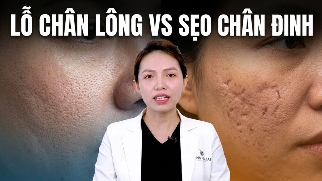 Lỗ chân lông to vs Sẹo chân đinh: Đâu là kẻ thù thực sự của làn da?
