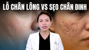 Lỗ chân lông to vs Sẹo chân đinh: Đâu là kẻ thù thực sự của làn da?