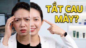 Tôi có nhăn cau mày phải làm sao?