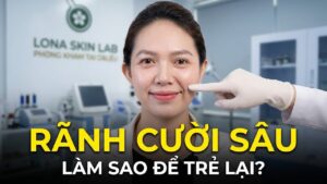 Rãnh cười sâu: Làm sao để trẻ lại mà không bị đơ mặt?