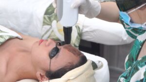 Khách đeo kính bảo hộ che mắt trong lúc kỹ thuật viên đưa đầu máy cầm tay lên vùng má — Phòng khám Chuyên khoa Da liễu Lona Skin Lab, Cần Thơ