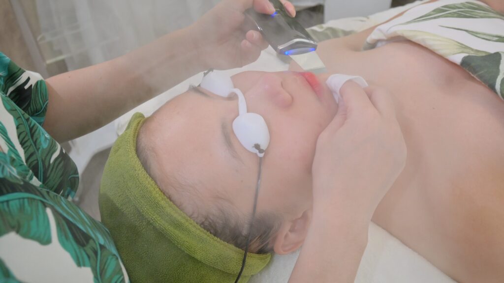 Thiết bị hai đầu tròn di chuyển trên vùng má trong lúc khách nhắm mắt — Phòng khám Chuyên khoa Da liễu Lona Skin Lab, Cần Thơ