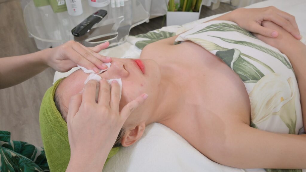 Thao tác tay trên vùng má khách, miếng lót trắng che vùng mắt — Phòng khám Chuyên khoa Da liễu Lona Skin Lab, Cần Thơ