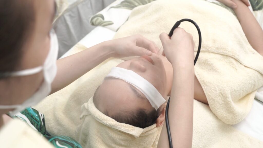 Đầu máy được đưa lên vùng da mặt của khách có khăn che tóc — Phòng khám Chuyên khoa Da liễu Lona Skin Lab, Cần Thơ